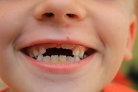 Teeth.jpg