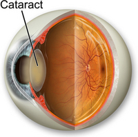 Anatomy-of-the-eye