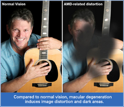 Example-of-Vision-with-and-without-Macular-Degeneration