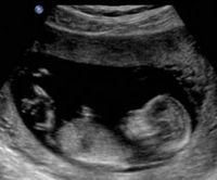 BabyUltrasound.jpg