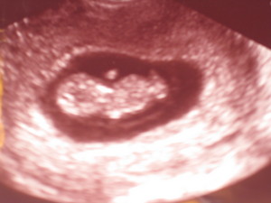shand_ultrasound.JPG