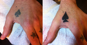 4-18-before-after-spades-tats.jpg